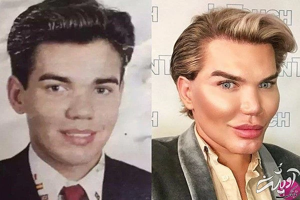 رکورد جراحی پلاستیک (1)